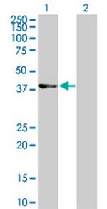 CDK9 Antibody in Western Blot (WB)