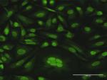 CDKN2D Antibody in Immunocytochemistry (ICC/IF)