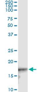 CDKN2D Antibody in Immunoprecipitation (IP)