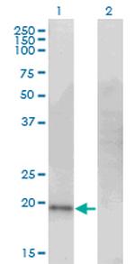 CDO1 Antibody in Western Blot (WB)