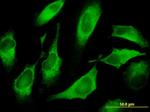 CDS1 Antibody in Immunocytochemistry (ICC/IF)