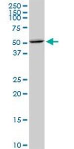 CDS1 Antibody in Western Blot (WB)