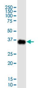 CDX2 Antibody in Western Blot (WB)