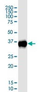 CDX2 Antibody in Western Blot (WB)