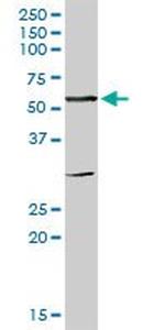 CES1 Antibody in Western Blot (WB)