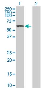 CES1 Antibody in Western Blot (WB)