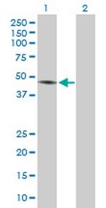 RCC1 Antibody in Western Blot (WB)