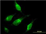 CHD1 Antibody in Immunocytochemistry (ICC/IF)