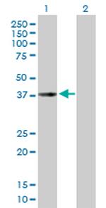 CHI3L2 Antibody in Western Blot (WB)