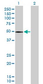 CHIT1 Antibody in Western Blot (WB)