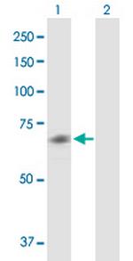 CHRM5 Antibody in Western Blot (WB)