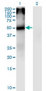 CHRNA5 Antibody in Western Blot (WB)