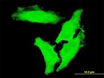 CHUK Antibody in Immunocytochemistry (ICC/IF)