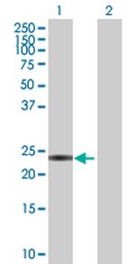 CIDEA Antibody in Western Blot (WB)