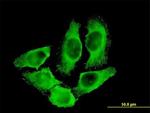 CKM Antibody in Immunocytochemistry (ICC/IF)