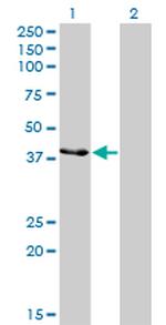 CKMT1B Antibody in Western Blot (WB)
