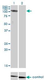 CLCN2 Antibody in Western Blot (WB)