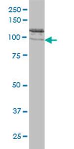 CLCN2 Antibody in Western Blot (WB)