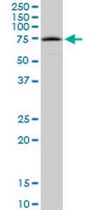 TPP1 Antibody in Western Blot (WB)