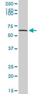 TPP1 Antibody in Western Blot (WB)