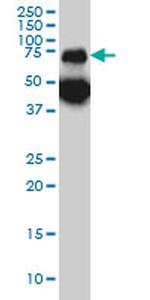 TPP1 Antibody in Western Blot (WB)