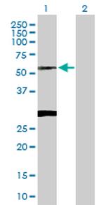 CLN3 Antibody in Western Blot (WB)