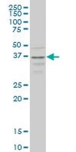 CCR2 Antibody in Western Blot (WB)