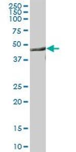 CNP Antibody in Western Blot (WB)