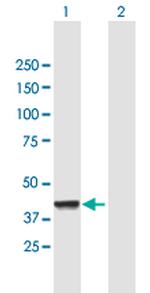 CNP Antibody in Western Blot (WB)