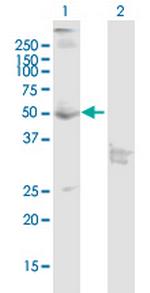 CNR1 Antibody in Western Blot (WB)