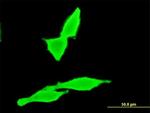 CNR2 Antibody in Immunocytochemistry (ICC/IF)