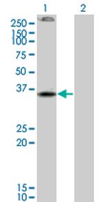 CNR2 Antibody in Western Blot (WB)