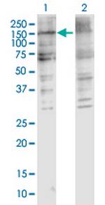 COL5A2 Antibody in Western Blot (WB)