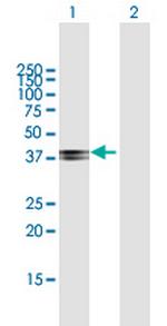 COL9A1 Antibody in Western Blot (WB)