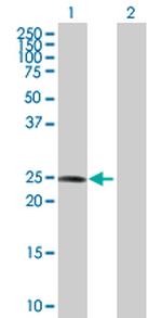 COMT Antibody in Western Blot (WB)