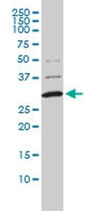 COMT Antibody in Western Blot (WB)