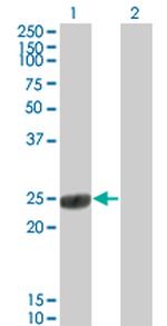 COMT Antibody in Western Blot (WB)