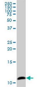 COX6B1 Antibody in Western Blot (WB)