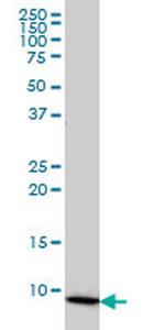 COX6B1 Antibody in Western Blot (WB)