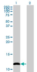 COX6B1 Antibody in Western Blot (WB)