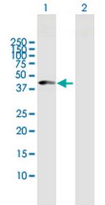 CPB1 Antibody in Western Blot (WB)