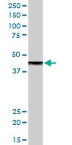 CPB1 Antibody in Western Blot (WB)