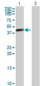 CPB1 Antibody in Western Blot (WB)