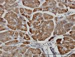 CPB1 Antibody in Immunohistochemistry (Paraffin) (IHC (P))