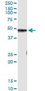 CPB1 Antibody in Immunoprecipitation (IP)