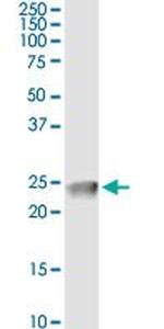 CLDN4 Antibody in Immunoprecipitation (IP)