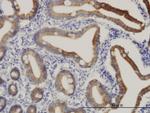 CPS1 Antibody in Immunohistochemistry (Paraffin) (IHC (P))