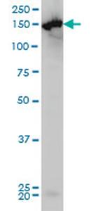 CPS1 Antibody in Western Blot (WB)