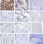 CPS1 Antibody in Immunohistochemistry (Paraffin) (IHC (P))