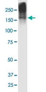 CPS1 Antibody in Western Blot (WB)